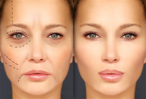 10 Best Cosmetic Surgery Make